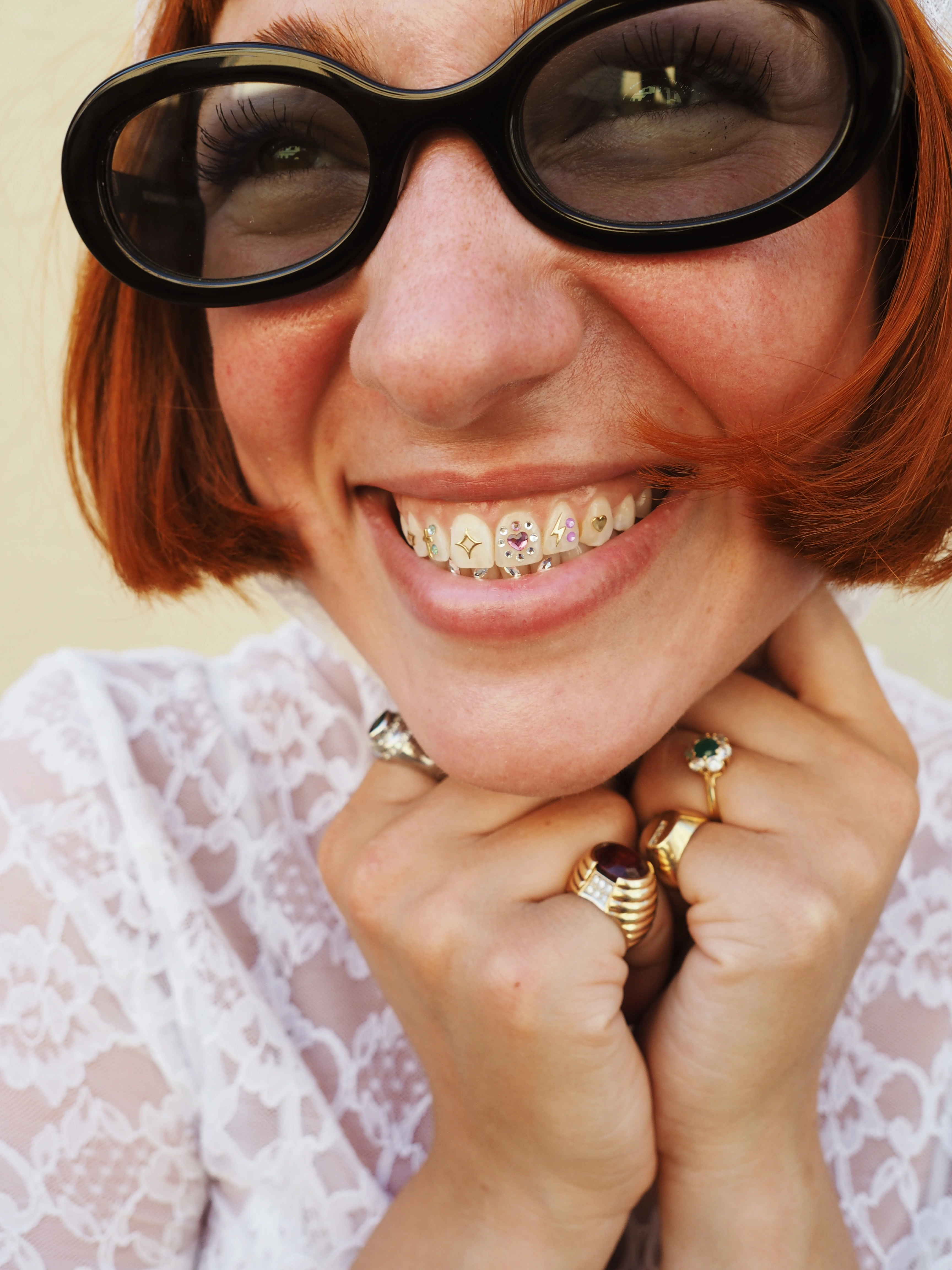 Joyas Dentales Luce